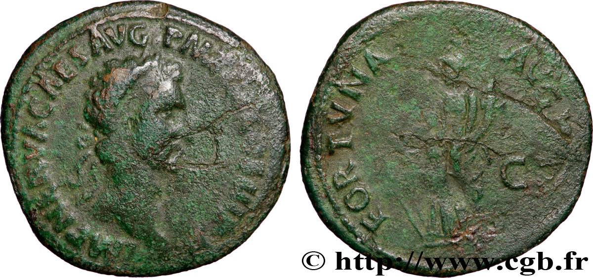 NERVA As TB